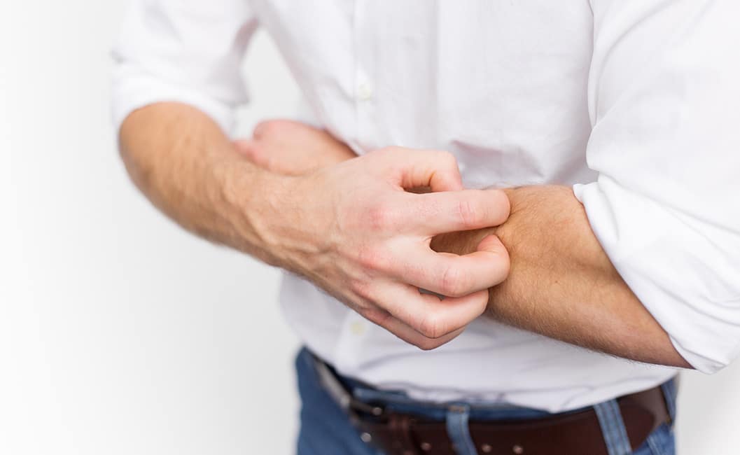 Curare Psoriasi Cannabis Light CBD